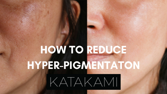 How to reduce hyper-pigmentation: skincare ingredients to look out for