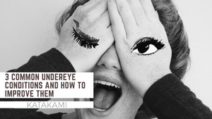 3 Common under eye conditions and how to improve them